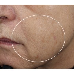 AGELESS+ retinol overnight masque 0.5% retinol complex